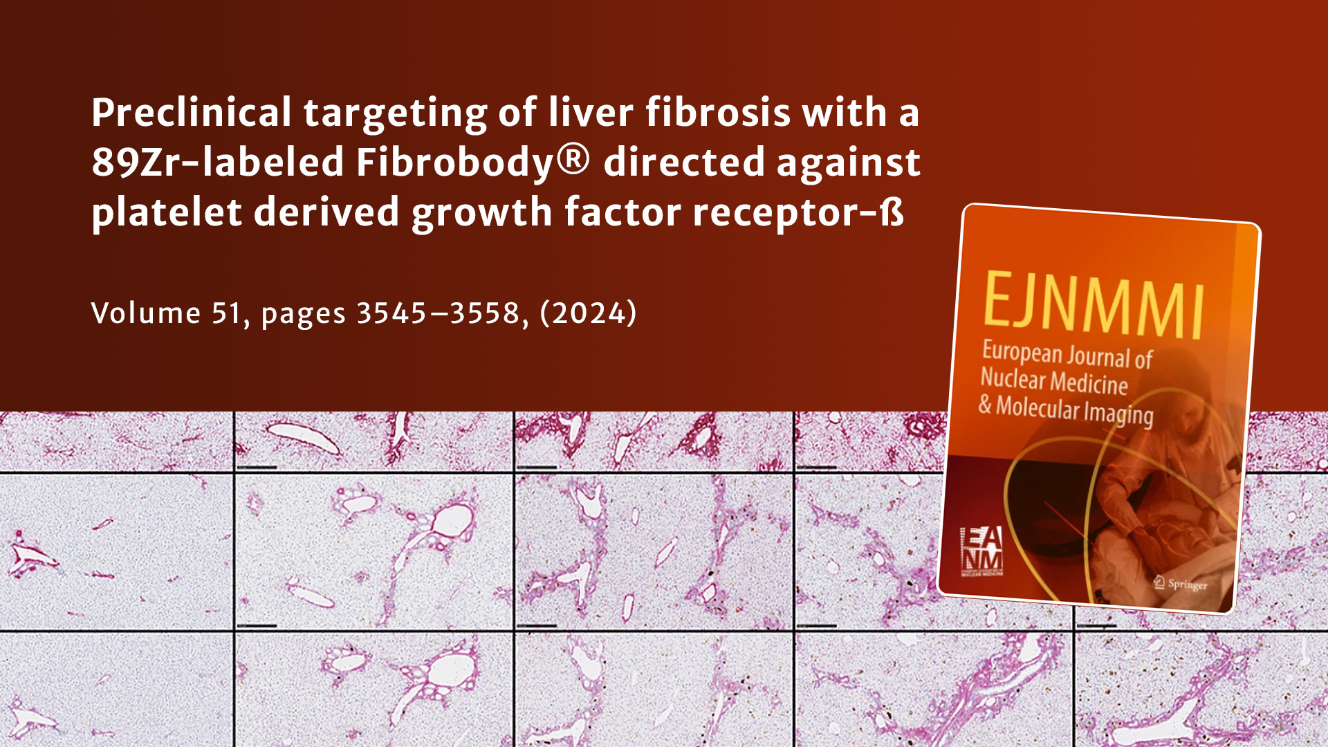 Image LinXis publishes key paper on lead Fibrobody® in EJNMMI